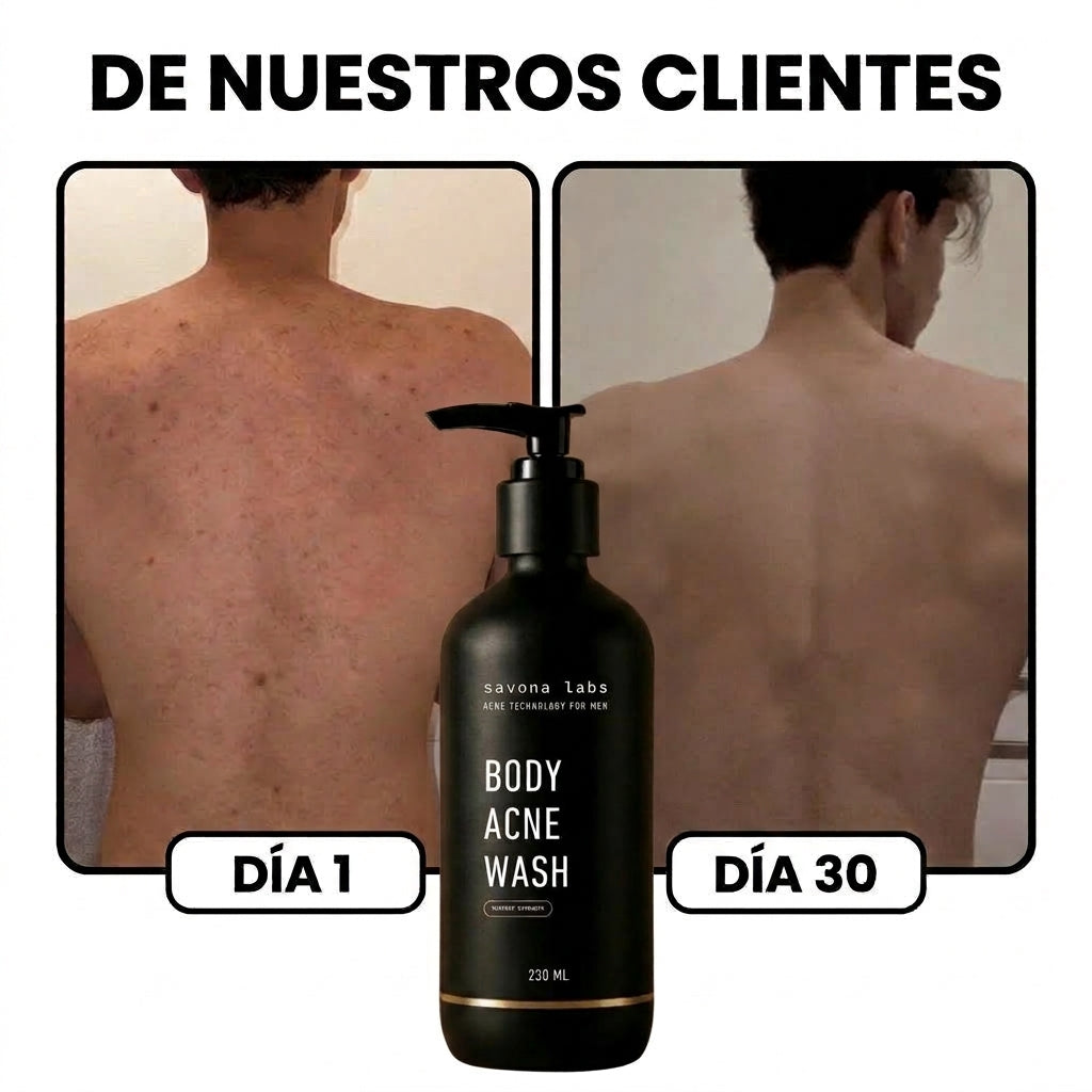 BODY ACNE WASH®