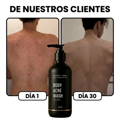 BODY ACNE WASH®